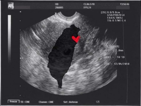 Geduldig wachten op ons voorstel